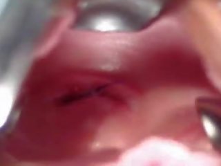 Изключителен клуб: рейчъл гинекомастия рефлектор изричен извратен гинекомастия преглед от стар surgeon
